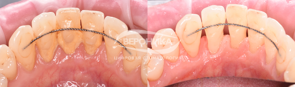 профгигиена профгигиена